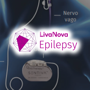VNS Epilepsia